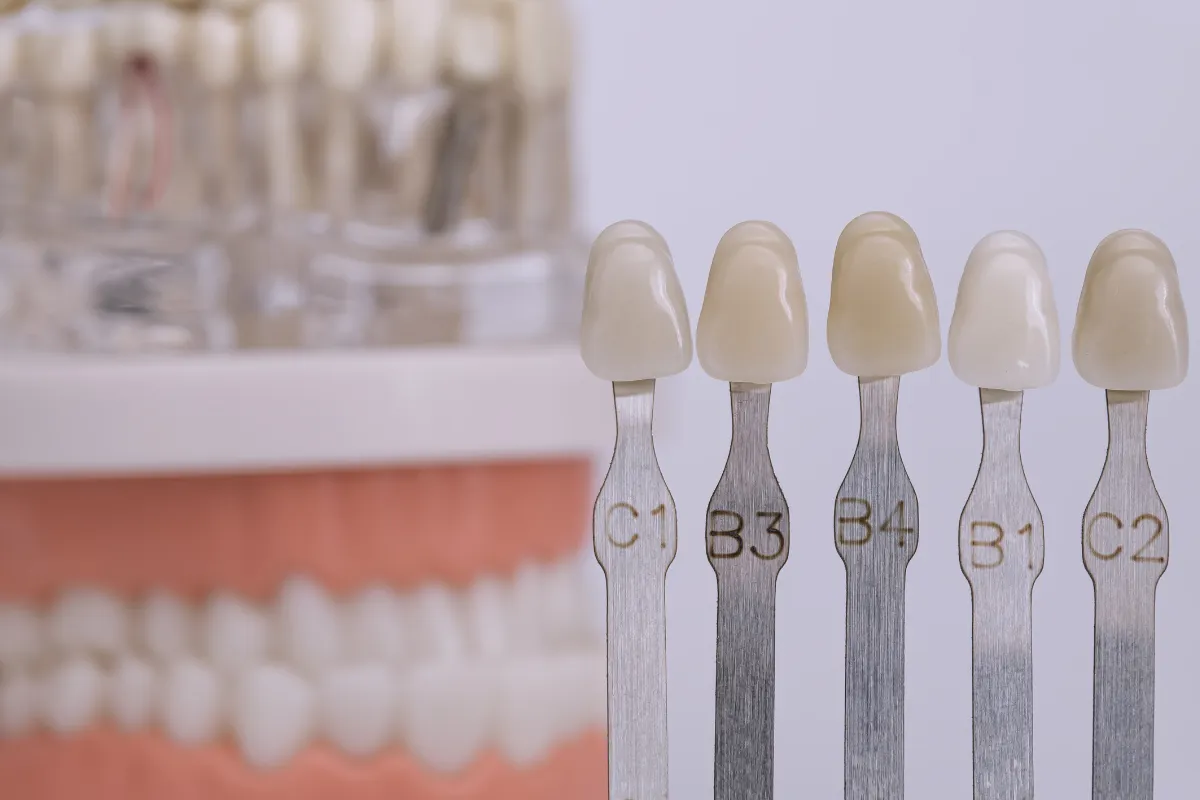 Types of Dental Crowns