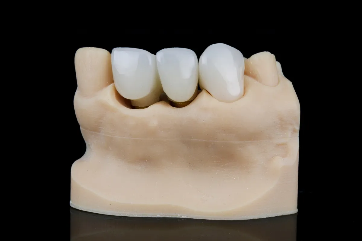 Why Choose Our Barrhaven Dental Clinic