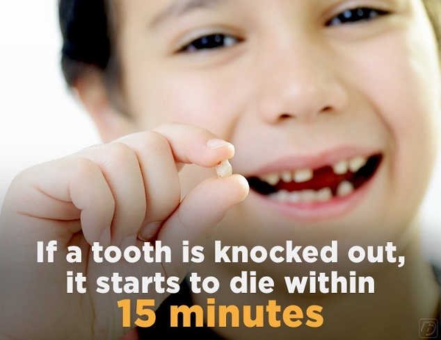 this is an image of a knocked out tooth